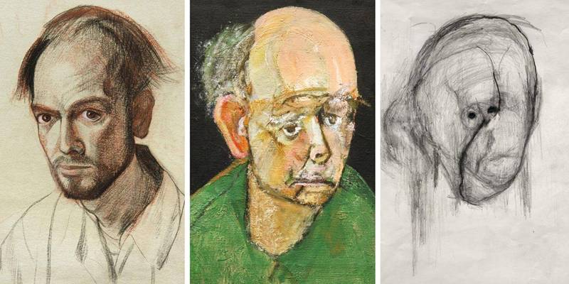 A evolução da doença Alzheimer através da arte